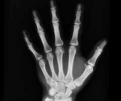 curso tecnicas radiologicas curso tecnicas radiologicas