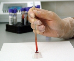 hematologia hematologia