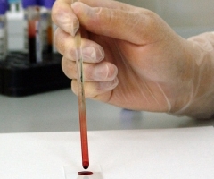 hematologia e inmunologia hematologia e inmunologia