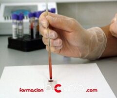 Función en los laboratorios de hematología