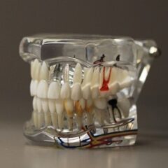 Técnicos Superiores en Prótesis Dentales