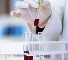 pruebas hematologicas diagnosticas-1336664__340 pruebas hematologicas diagnosticas-1336664__340