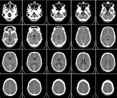 radiología-62942__340 radiología-62942__340