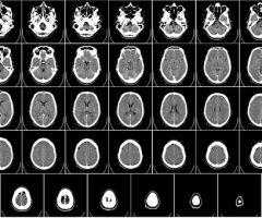 radiología-62942__340 radiología-62942__340