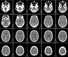 radiología-62942__340-1 radiología-62942__340-1