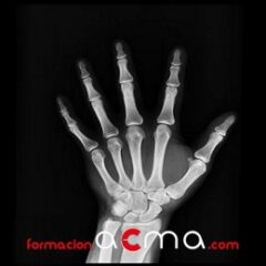 Radiología de urgencias