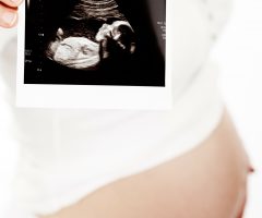 cuidados obstetricia cuidados obstetricia