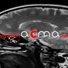 Curso gratuito baremables oposiciones puntuables categoría Radioterapia