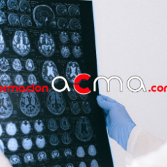 curso radiología radioterapia