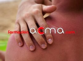 curso formacion acma quemadura