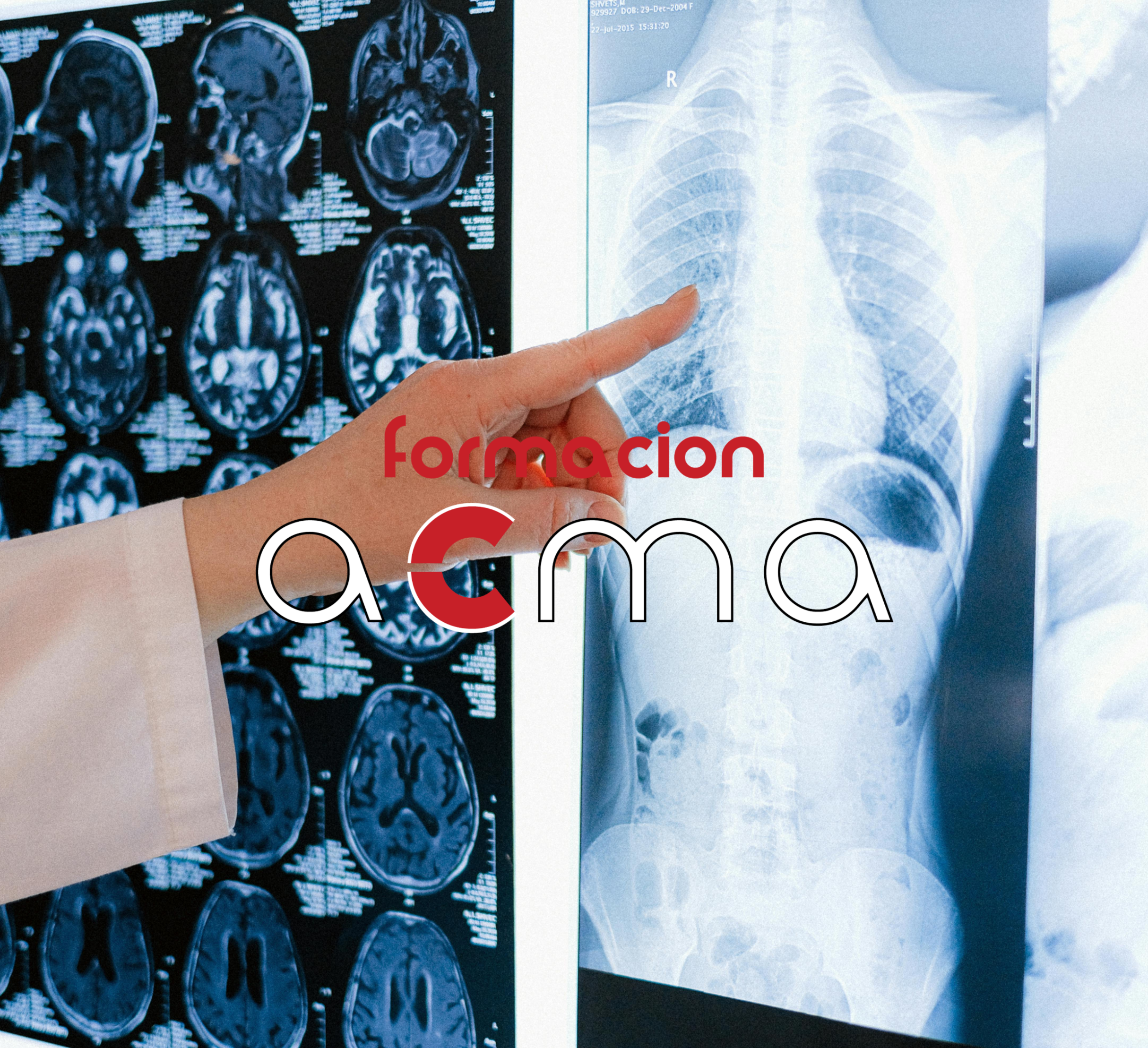 Formación ACMA - curso medicina nuclear